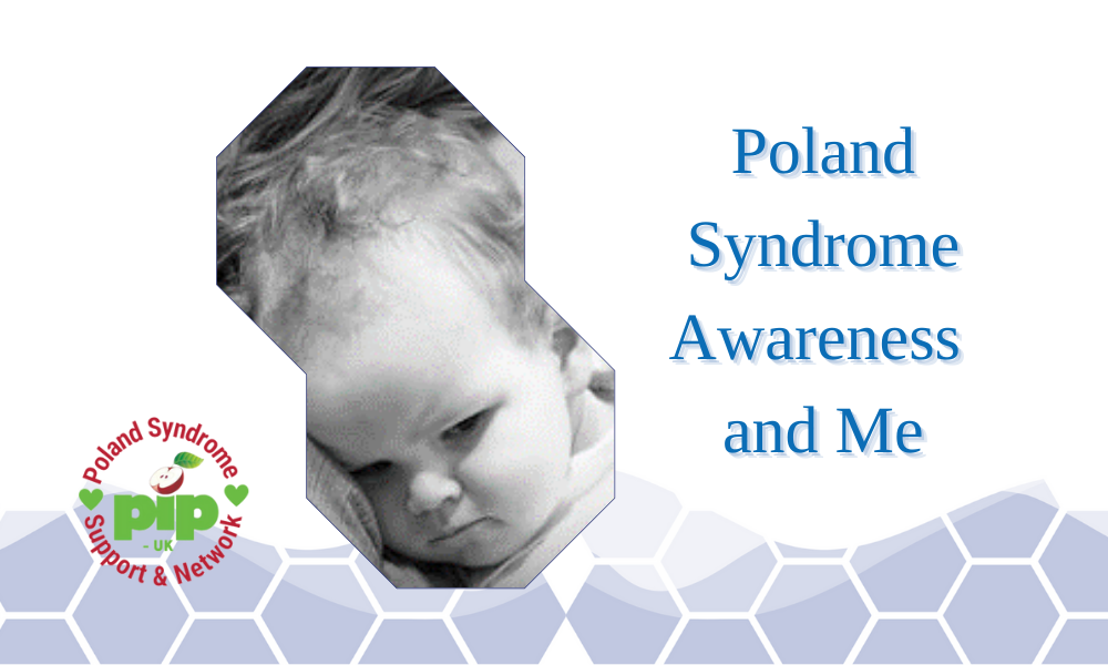 Poland Syndrome Awareness and Me