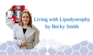 Life with Lipodystrophy by Becky Smith Becky is wearing a tan grey coat with a black handbag. There is a bus in the background of thee photo.
